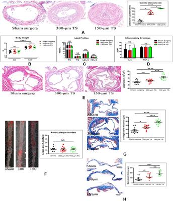 Carotid Occlusion Accentuates Aortic Stenosis and Cardiac Remodeling With Preserved Systolic Function in LDL Receptor-Deficient Mice